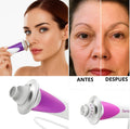 DERMAWAND PARA ARRUGAS, FLACIDEZ Y OTROS